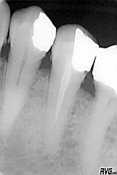 34 35 jfwr1t - Eugenol