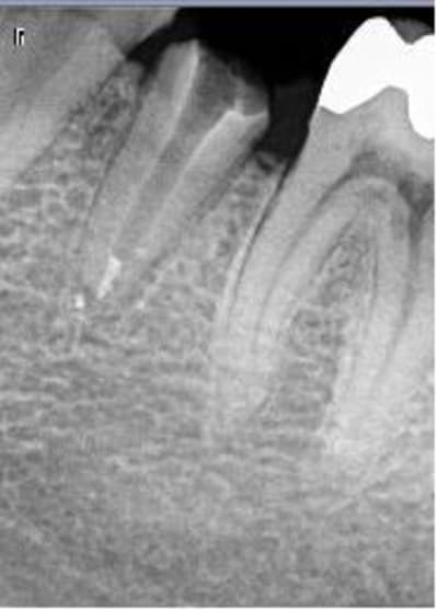 35bis fhe3wx - Eugenol