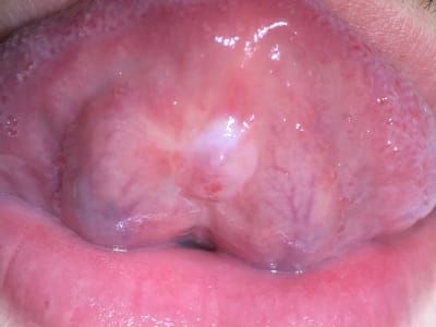 37739166 10156546019264771 7894057801654206464 n ji45ca - Eugenol