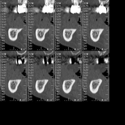 378 xy1lob - Eugenol