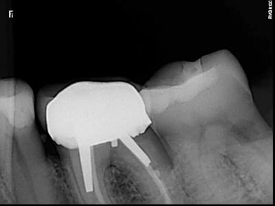 37 angulation m siale ynhqin - Eugenol