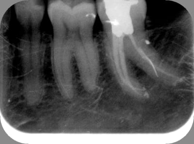 37 v40jxp - Eugenol