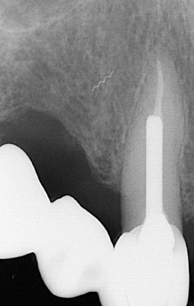 37h7xd54f4g1ksvfymt4ykr10946 - Eugenol