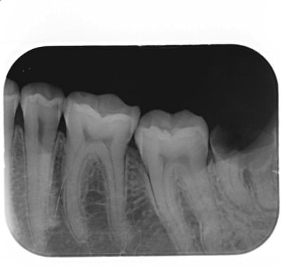 38 t0szhy - Eugenol