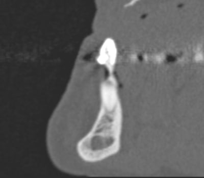 3d3 vr image ngjj5b - Eugenol