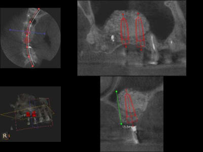 3dslice1 2011 01 21 12 52 34 v3corj - Eugenol