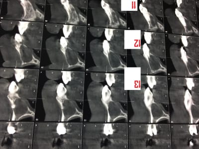 3d kyste 11 12 13 fo11wr - Eugenol