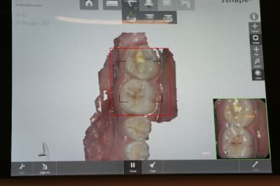 3d shape 2 wgvewl - Eugenol