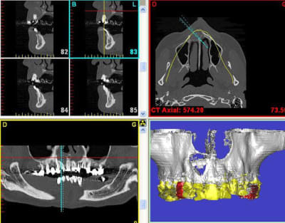 3d cmfmis - Eugenol
