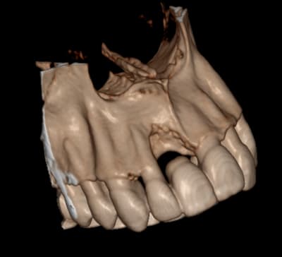 3d qethqx - Eugenol