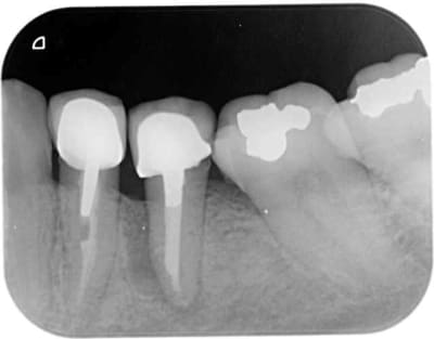 3 bis lze40t - Eugenol