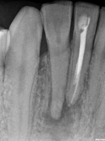 41 42 us6w9m - Eugenol