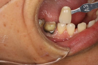 46 a3 apr s  claircissement ufwkdr - Eugenol