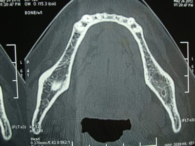 468 fepmvt - Eugenol