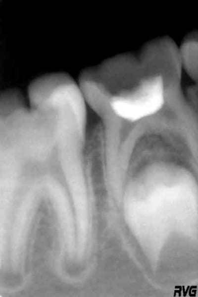 46 d cembre 2008 nftkle - Eugenol