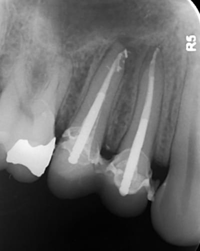 4   01102015 qpptkm - Eugenol