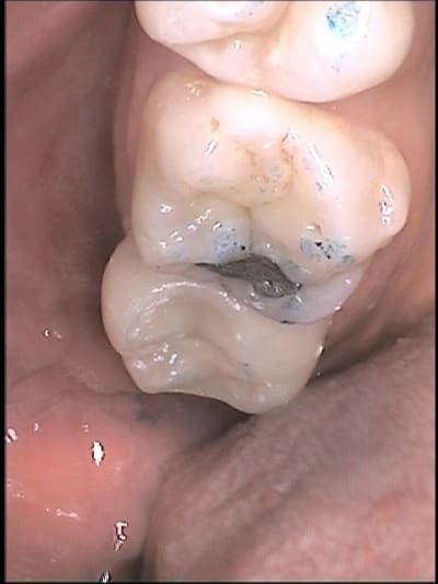 4 lcc6q3 - Eugenol