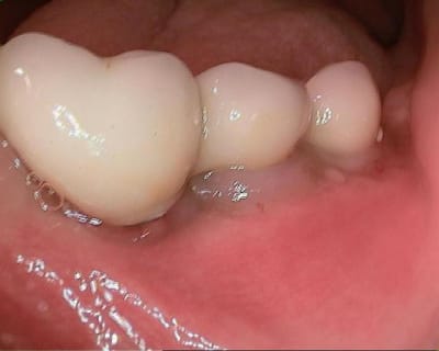 50 20120630 131431 uinran - Eugenol