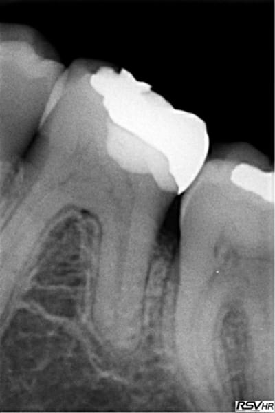 5 ans2 nkwp4j - Eugenol