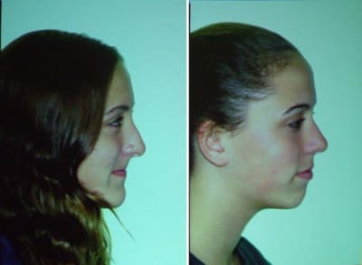 5 ans aprés 1 bqpkc5 - Eugenol