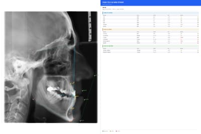 5eyzyc2zngdo79ap2xw071x4ibpz - Eugenol