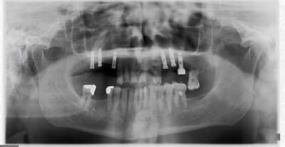 6032013 155033 ekedet - Eugenol