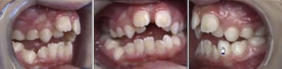 6991 avant nlzkim - Eugenol
