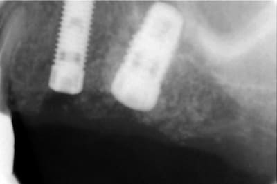 6  800x600  piyuf5 - Eugenol