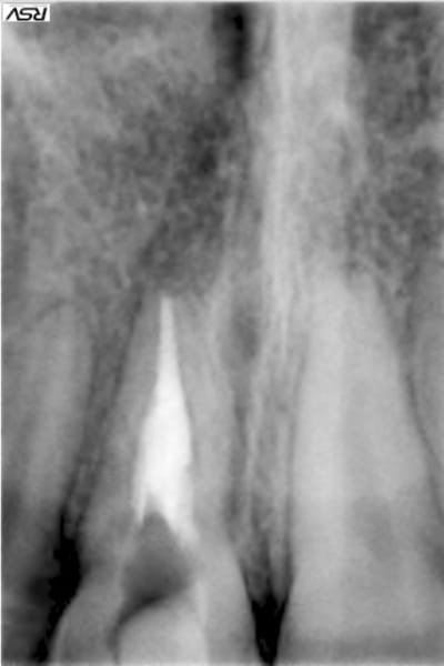 6 alrbjd - Eugenol