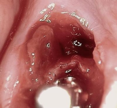 6 y83bmr - Eugenol