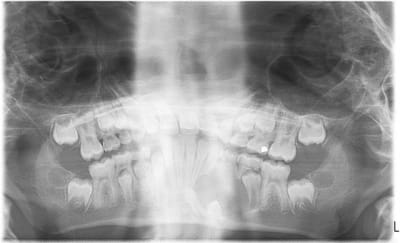 73 74 75 awxkld - Eugenol