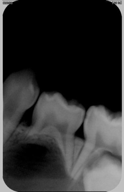 74 avant ext iqm7tn - Eugenol