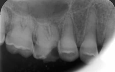 781774c1 a8e8 49b4 8faa 683eca2bb0a4 u2c9ob - Eugenol