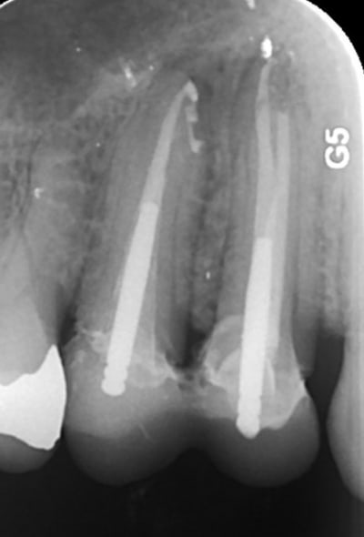 7   26102015 hu5h99 - Eugenol