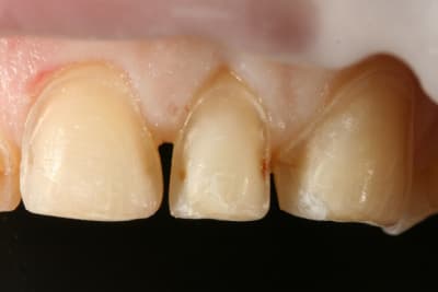 7 dents pr par es 2 s5eeb9 - Eugenol