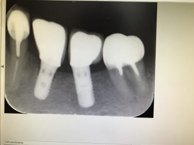 857d84de 846a 4c1d 9874 72fba466aefa uc7c6z - Eugenol