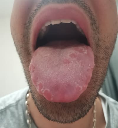 86vdvngd4g739pc2nphiyk30yd4s - Eugenol