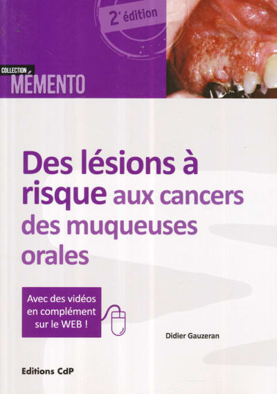 9782843612602 lesions risque cancers muqueuses orales g xvzryz - Eugenol