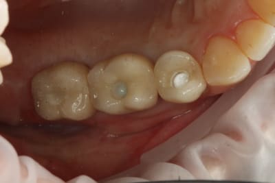 98 crowns 2 u8h1jr - Eugenol