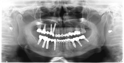 9mois post prot max os3cyi - Eugenol