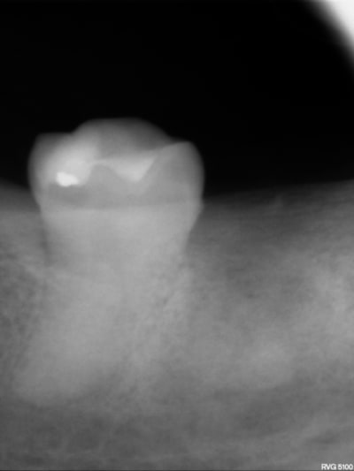 A10 gpf70r - Eugenol