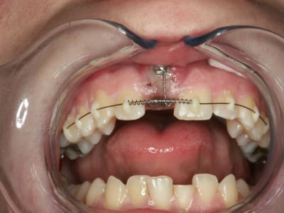 A14 ygi6gz - Eugenol