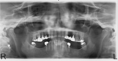 A35 afuh6m - Eugenol
