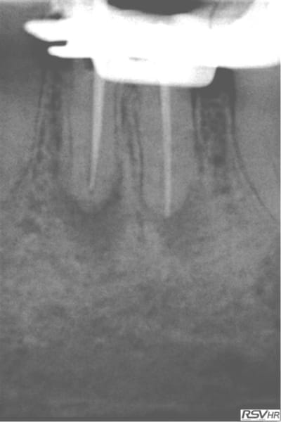 Al2 sxefia - Eugenol