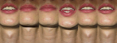 A pommeadam iwtzoa - Eugenol