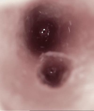 Alveole 3 ptxxut - Eugenol