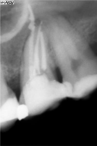 B2bis mz3xlx - Eugenol