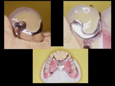 Buis 1 ekcgfu - Eugenol