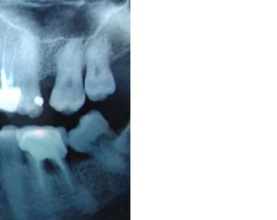 Bout pano kkhitm - Eugenol