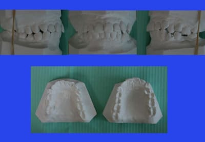 Bridge 1 obz0ey - Eugenol